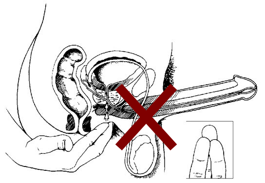 Метод на трите пръста - неправилно разположение на пръстите-  Даоски сексуални методи за съхранение на здравето